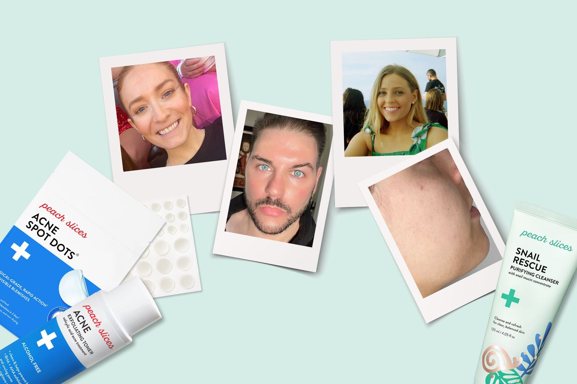 Our team members share their personal journeys towards calm, clear skin.