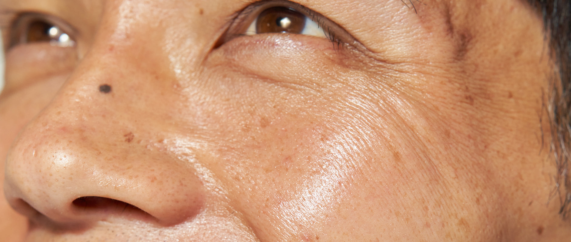 Peach & Lily Skin Concern - Pores