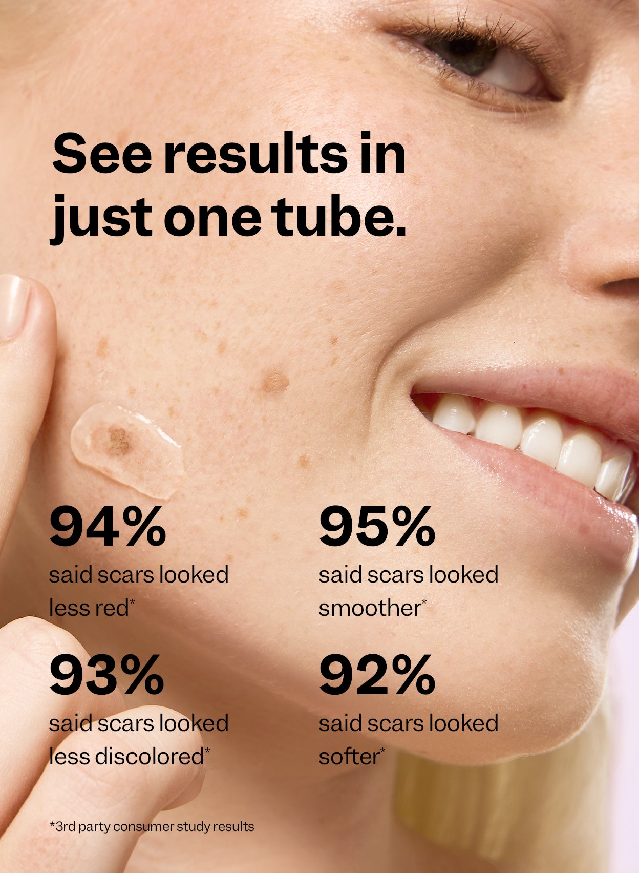 In a 3rd party consumer study, 92%+ of users said scars looked smoother, softer, less red, and less discolored after using one tube.