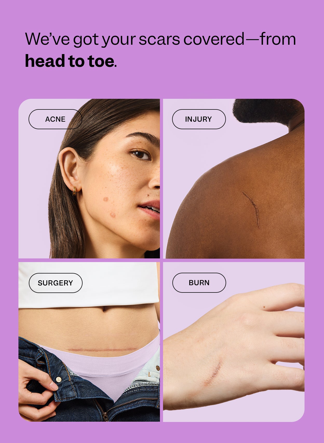 Designed to visibly improve the look of a variety of raised scar types including  acne, injury, surgery, and burns.